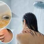 shower, murky water inset, skin irritation